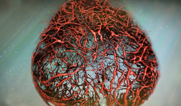 ارگانوئید پانکراسی رگ‌دار